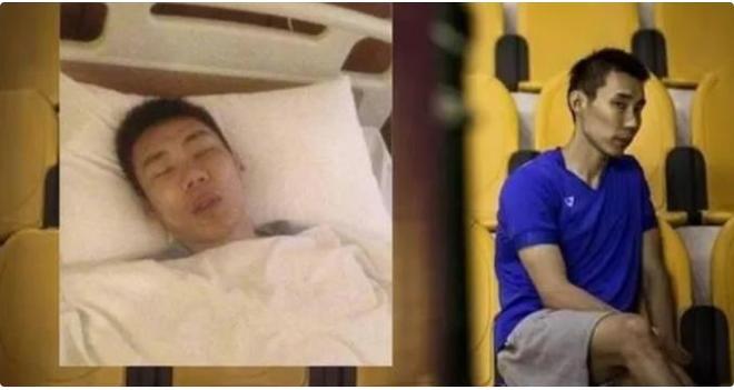 年抗癌终治愈喉咙疼到吃饭得喷麻药j9平台“大马一哥”李宗伟：2(图20)